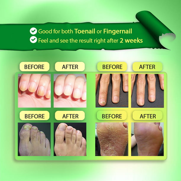 Characteristics Tissue Skin Finger Human Nail Stock Photo 2275236041 |  Shutterstock